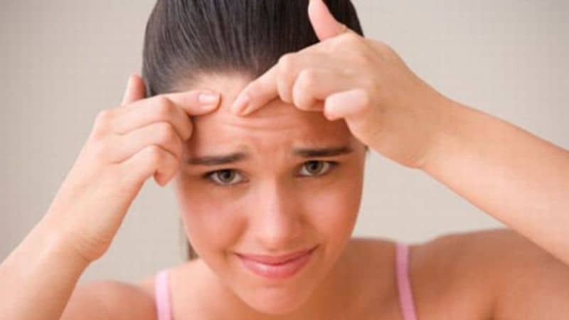 Important tips to get rid of winter acne
