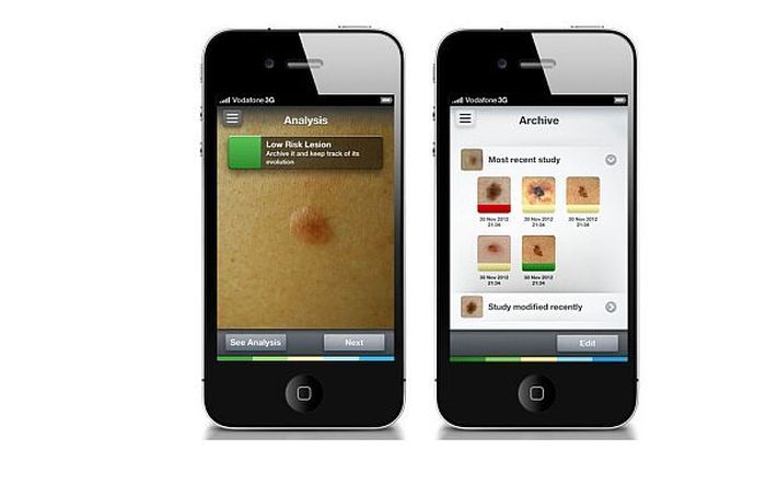 SkinVision app - Review