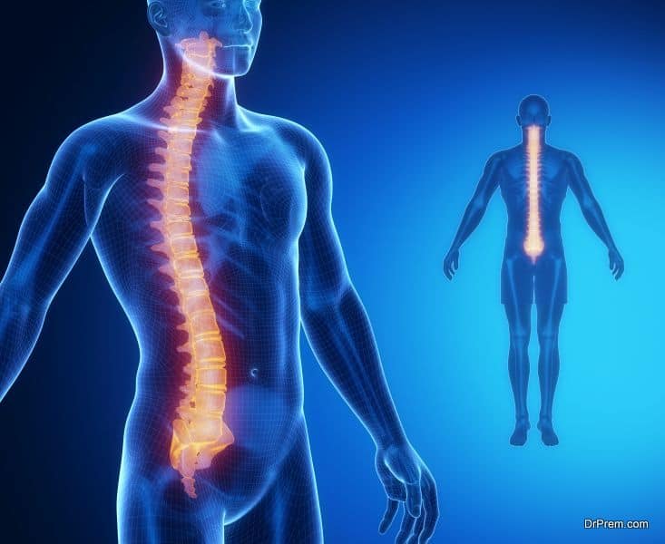spinal implants